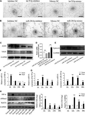 Exosomes Derived From Hypoxia-Conditioned Stem Cells of Human Deciduous Exfoliated Teeth Enhance Angiogenesis via the Transfer of let-7f-5p and miR-210-3p